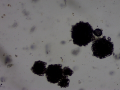 Dolichospermum lemmermannii