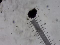 Dolichospermum lemmermannii