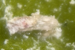 Caecum