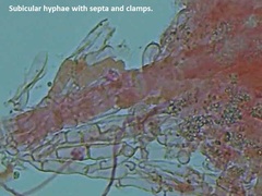 Hyphoderma