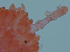 Hyphoderma