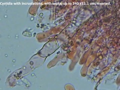 Hyphoderma