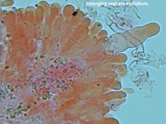 Hyphoderma