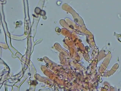 Hyphoderma