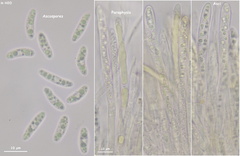 Chlorencoelia versiformis