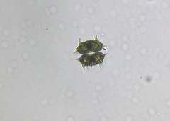 Xanthidium antilopaeum
