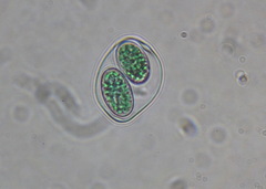 Glaucocystis