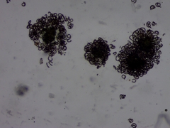 Dolichospermum lemmermannii