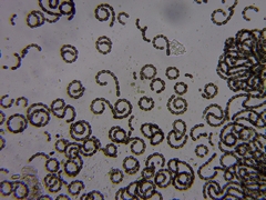 Dolichospermum lemmermannii