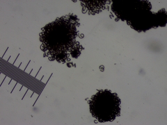 Dolichospermum lemmermannii