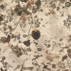 Lecane closterocerca