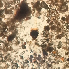 Lecane aculeata