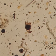 Keratella cochlearis