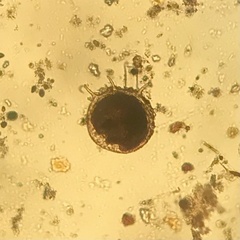 Centropyxis discoides