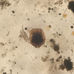 Brachionus angularis