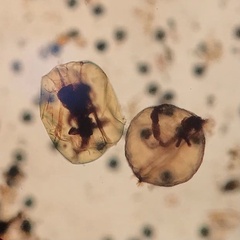 Asplanchna herricki