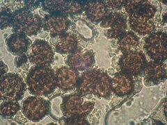 Scleroderma areolatum