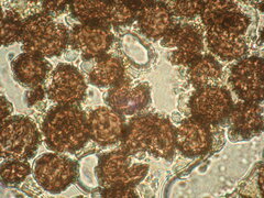 Scleroderma areolatum
