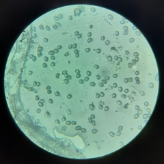 Tricholomella constricta