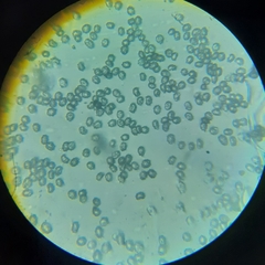 Tricholomella constricta