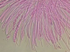 Sclerotinia