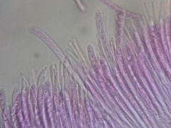 Sclerotinia