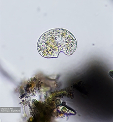 Colpoda