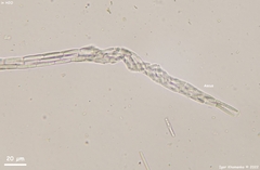 Tolypocladium capitatum