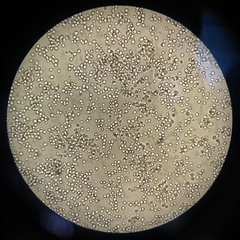 Saccharomyces cerevisiae