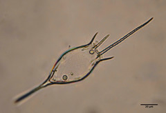 Kellicottia bostoniensis