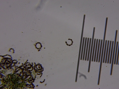 Dolichospermum lemmermannii