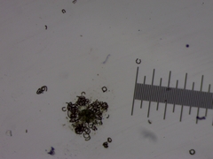 Dolichospermum lemmermannii