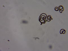 Dolichospermum lemmermannii