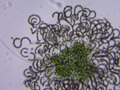 Dolichospermum lemmermannii