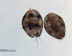 Ostracoda