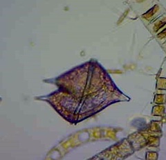 Protoperidinium