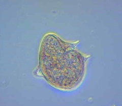 Protoperidinium depressum