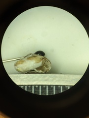 Ventridens suppressus