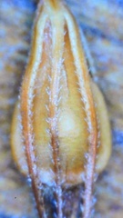 Rhynchospora glomerata angusta