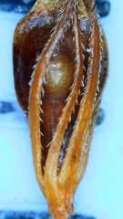 Rhynchospora glomerata angusta