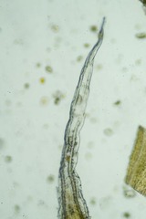 Racomitrium ericoides