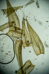 Racomitrium ericoides