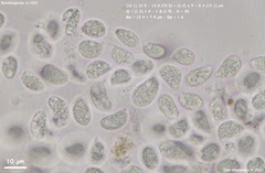 Sebacina sparassoidea