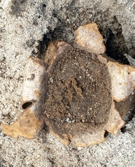 Scleroderma