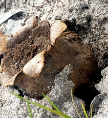Scleroderma
