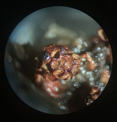 Metatrichia vesparium