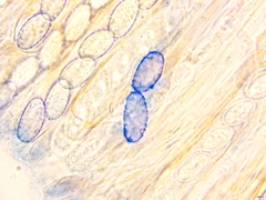 Scutellinia hirta