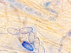 Scutellinia hirta