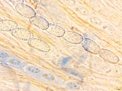 Scutellinia hirta