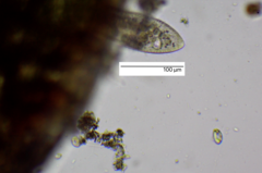 Paramecium